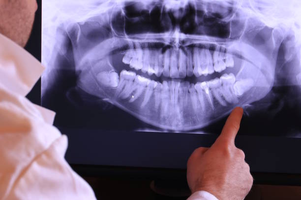 Best Emergency TMJ Treatment in San Marcos, TX