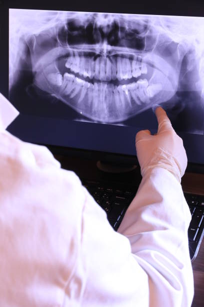 Best Emergency Wisdom Teeth Removal in San Marcos, TX